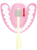 前方にかき出すように磨いてください。驚くほどきれいに舌苔除去ができます。　※舌に付着した歯垢は、舌苔(ぜったい)と呼ばれ、口臭の原因となります。
